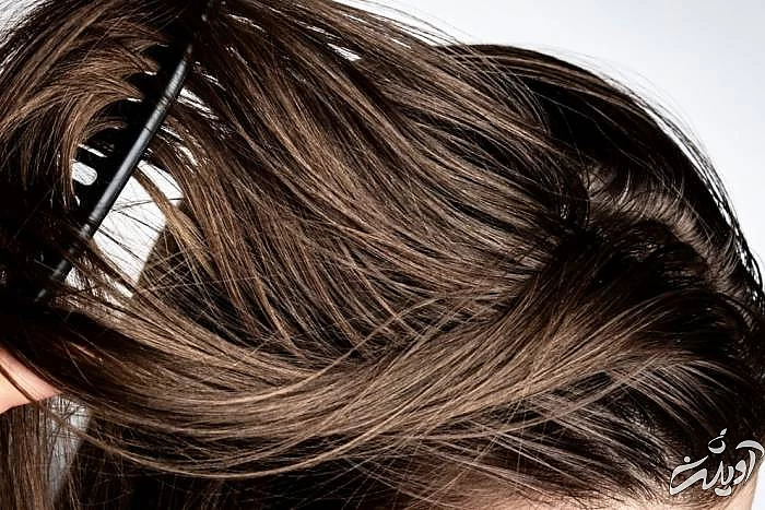 بوی بد موهای سر ناشی از موهای چرب موهای چرب